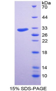 Figure 1. SDS-PAGE