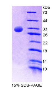 Figure 1. SDS-PAGE