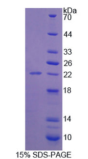 Figure 1. SDS-PAGE