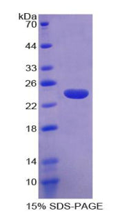 Figure 1. SDS-PAGE