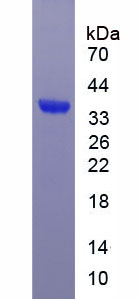 Figure 3. SDS-PAGE