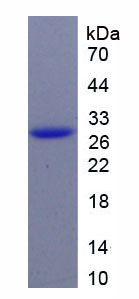 Figure 1. SDS-PAGE