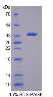 Figure 1. SDS-PAGE