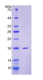 Figure 1. SDS-PAGE