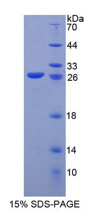 Figure 1. SDS-PAGE