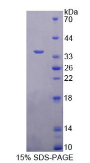 Figure 1. SDS-PAGE