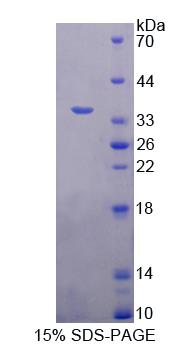 Figure 1. SDS-PAGE
