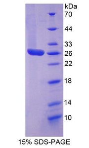 Figure 1. SDS-PAGE