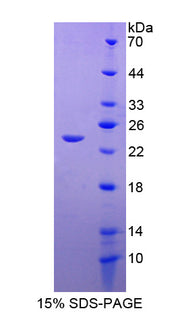 Figure 1. SDS-PAGE