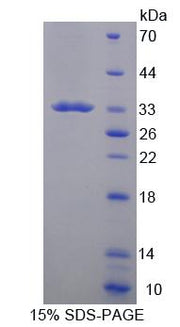 Figure 1. SDS-PAGE