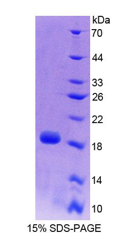 Figure 1. SDS-PAGE