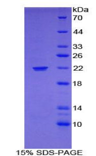 Figure 1. SDS-PAGE