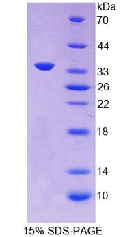 Figure 1. SDS-PAGE