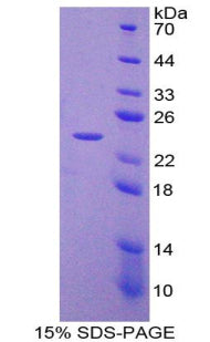 Figure 1. SDS-PAGE