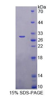 Figure 1. SDS-PAGE