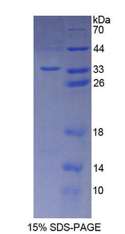 Figure 1. SDS-PAGE