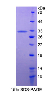 Figure 1. SDS-PAGE
