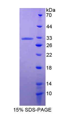 Figure 1. SDS-PAGE