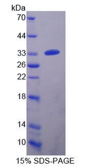 Figure 1. SDS-PAGE