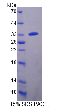 Figure 1. SDS-PAGE