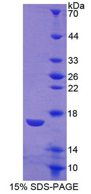 Figure 1. SDS-PAGE