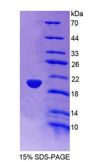 Figure 1. SDS-PAGE