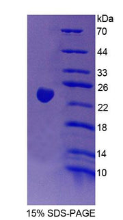 Figure 1. SDS-PAGE