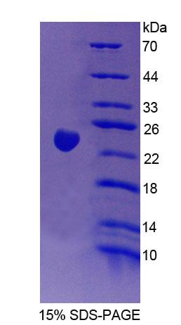 Figure 1. SDS-PAGE