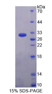 Figure 1. SDS-PAGE