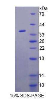 Figure 1. SDS-PAGE