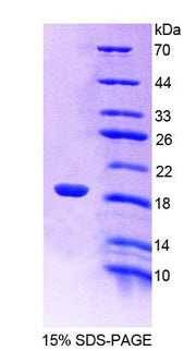 Figure 1. SDS-PAGE