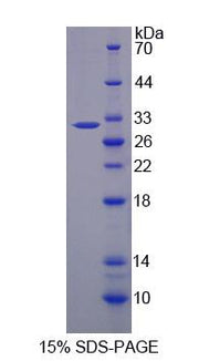 Figure 1. SDS-PAGE