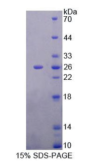 Figure 1. SDS-PAGE