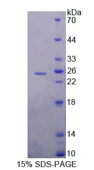 Figure 1. SDS-PAGE