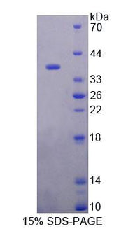 Figure 1. SDS-PAGE