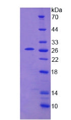 Figure 2. SDS-PAGE