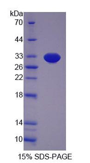 Figure 1. SDS-PAGE