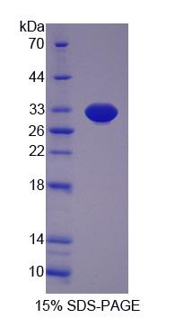 Figure 1. SDS-PAGE