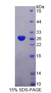 Figure 1. SDS-PAGE