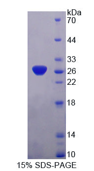 Figure 1. SDS-PAGE