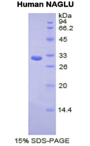 Figure 1. SDS-PAGE