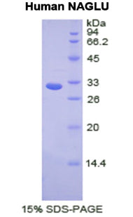 Figure 1. SDS-PAGE