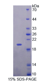 Figure 1. SDS-PAGE