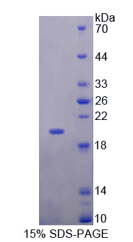 Figure 1. SDS-PAGE