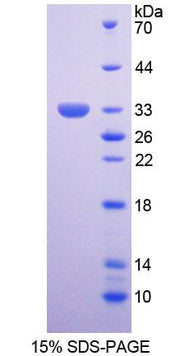 Figure 1. SDS-PAGE