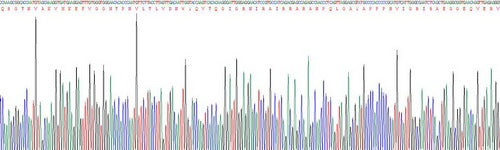 Recombinant Human Apolipoprotein L2 (APOL2)