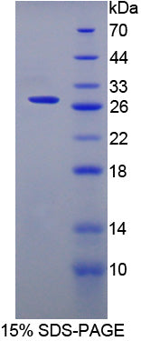 Figure 1. SDS-PAGE
