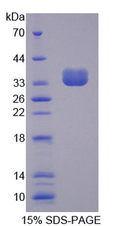 Figure 1. SDS-PAGE