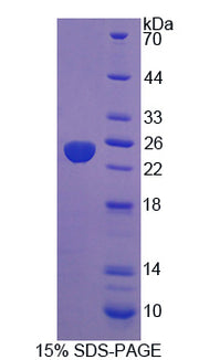 Figure 1. SDS-PAGE