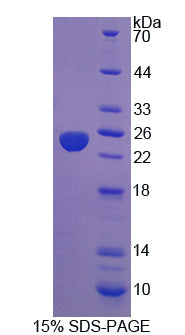 Figure 1. SDS-PAGE